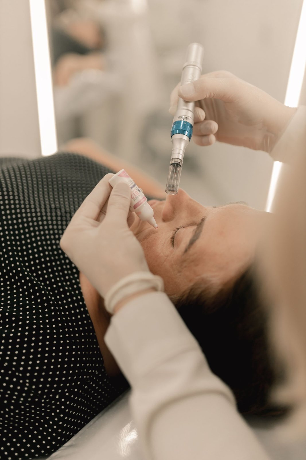 Microneedling-Pen bei einer Gesichtsbehandlung (Symbolbild)